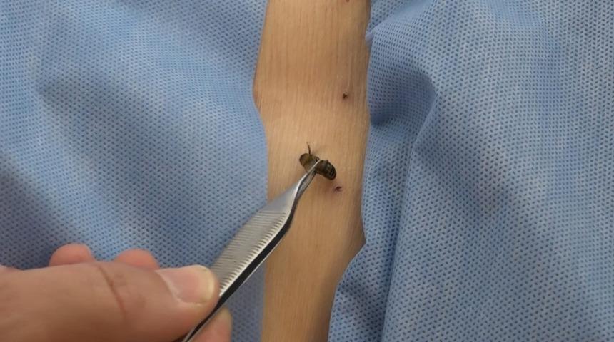 Bursa'da 5 bin yıllık tedavi: Bu arılar şifa dağıtıyor! Türkiye'nin her yerinden talep var