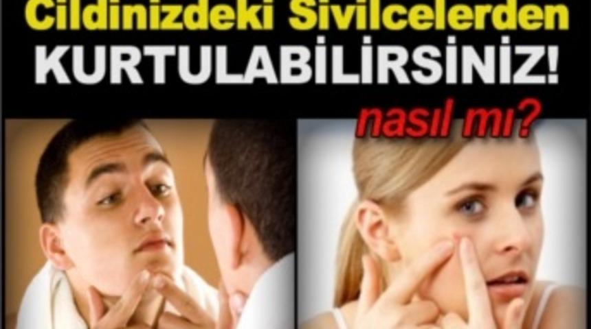 Cildinizdeki Sivilcelerden kurtulabilirsiniz!