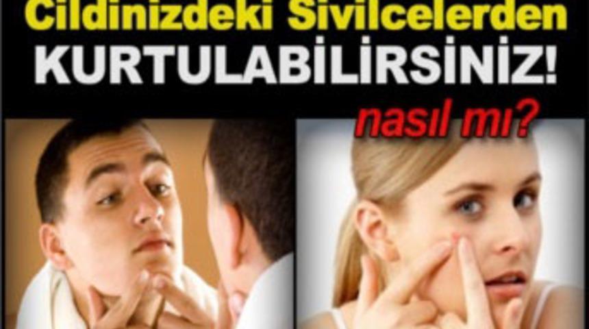 Cildinizdeki Sivilcelerden kurtulabilirsiniz!