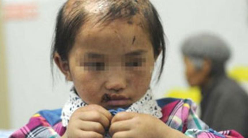 '&Ccedil;in&rsquo; işkencesi!