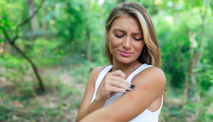 Arı sokmasına ne iyi gelir? Arı sokmasına ne yapılır?