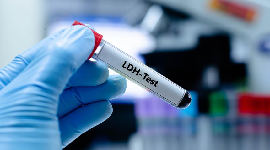 LDH (Laktat dehidrogenaz) nedir? LDH düşüklüğü ve yüksekliği