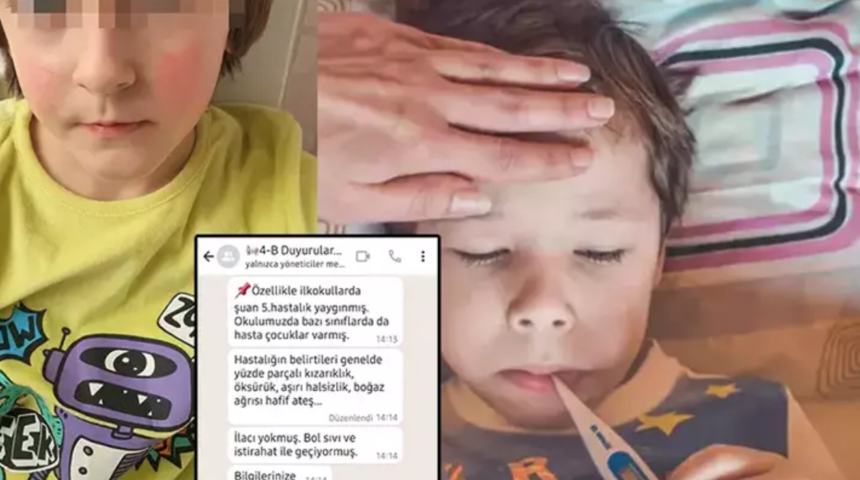 Baharın çocuklara kötü sürprizi: Beşinci hastalık! Veli gruplarında uyarılar hızla yayılıyor