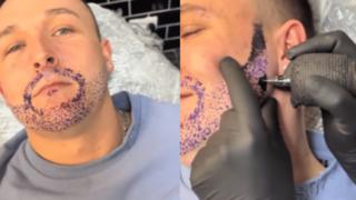 Sakalının uzamamasından şikayet eden adam bulduğu çözümle sosyal medyanın gündemine yerleşti! Hayatının en büyük hatası