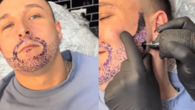 Sakalının uzamamasından şikayet eden adam bulduğu çözümle sosyal medyanın gündemine yerleşti! Hayatının en büyük hatası