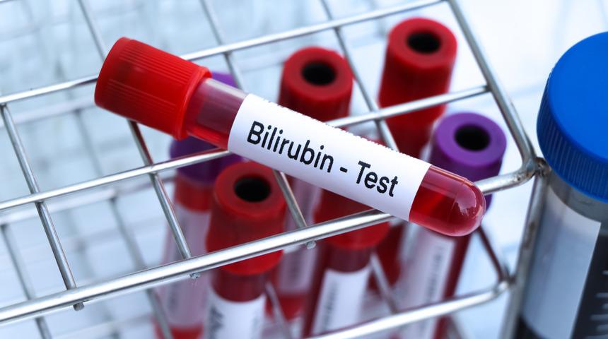 Bilirubin nedir, bilirubin normal değeri kaç olmalı? Bilirubin yüksekliği ve bilirubin düşüklüğü
