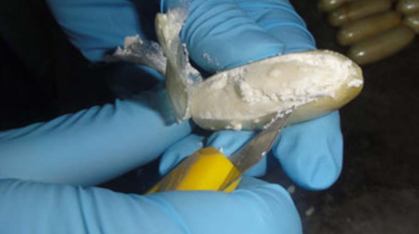 Sindirim sisteminden 119 kapsül kokain çıktı