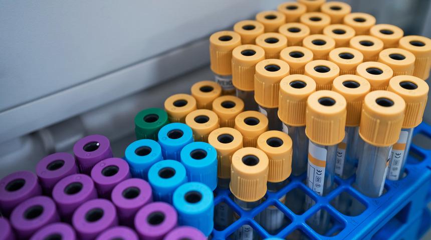 Trigliserid nedir? Trigliserid yüksekliği ve düşüklüğü ne anlama gelir, neden olur?