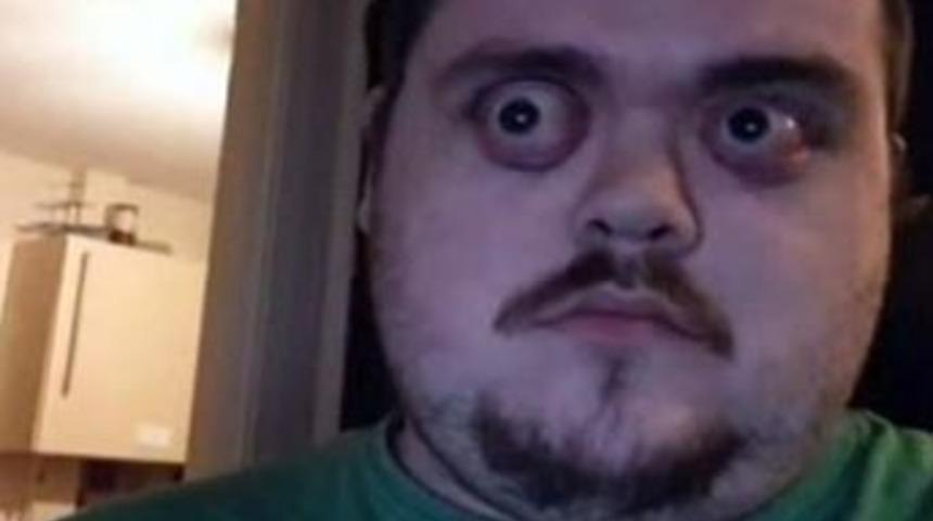 Bu adamın g&ouml;zlerine inanamayacaksınız!