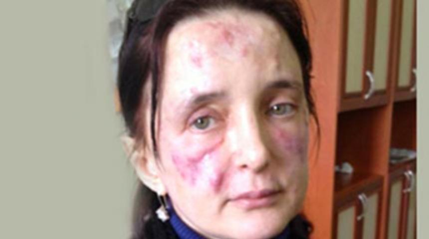 Makarna süzgeçli güzellik faciası