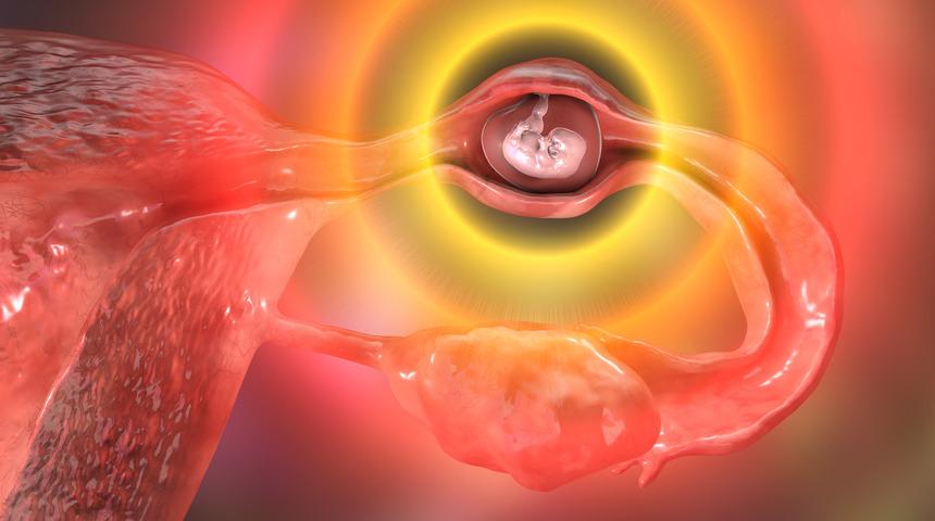 Dış gebelik nedir, nasıl belli olur? Dış gebelik belirtileri