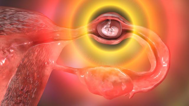 Dış gebelik nedir, nasıl belli olur? Dış gebelik belirtileri