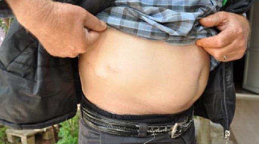 9 yıldır karnınla kurşunla yaşıyor