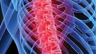 Karakteriniz sizi fıtık edebilir