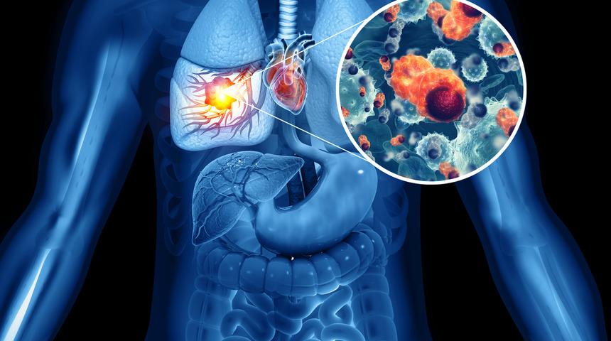 Prof. Dr. Tevfik Özlü: Bu hastalığa bağlı ölümler en çok genç yaşta! Tedavi edilmediğinde kötü sonuçlar doğuruyor