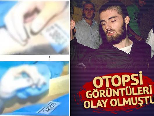 Cem Garipoğlu’nun otopsi görüntülerindeki o detay merak konusu olmuştu! İşte ellerindeki ‘morarmanın’ nedeni…