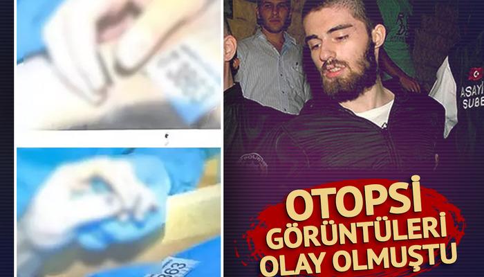 Cem Garipoğlu’nun otopsi görüntülerindeki o detay merak konusu olmuştu! İşte ellerindeki ‘morarmanın’ nedeni…