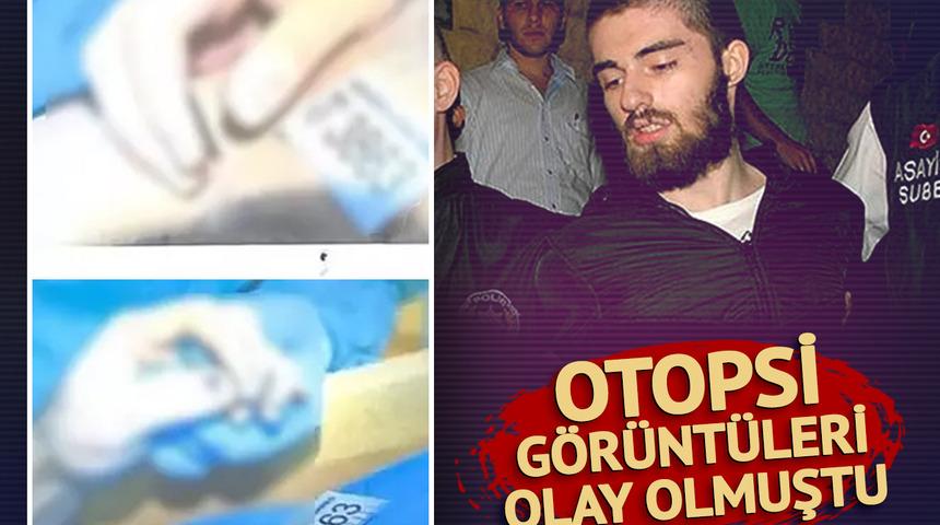 Cem Garipoğlu’nun otopsi görüntülerindeki o detay merak konusu olmuştu! İşte ellerindeki ‘morarmanın’ nedeni…