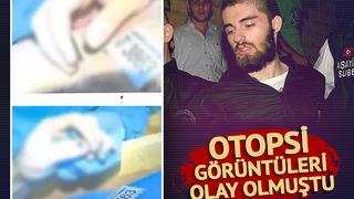 Cem Garipoğlu’nun otopsi görüntülerindeki o detay merak konusu olmuştu! İşte ellerindeki ‘morarmanın’ nedeni…