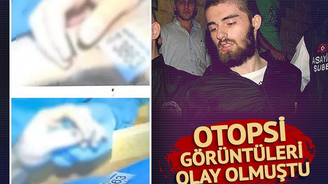 Cem Garipoğlu’nun otopsi görüntülerindeki o detay merak konusu olmuştu! İşte ellerindeki ‘morarmanın’ nedeni…