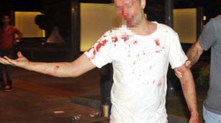 Eşini d&ouml;vmeye kalkınca lin&ccedil; edilmek istendi