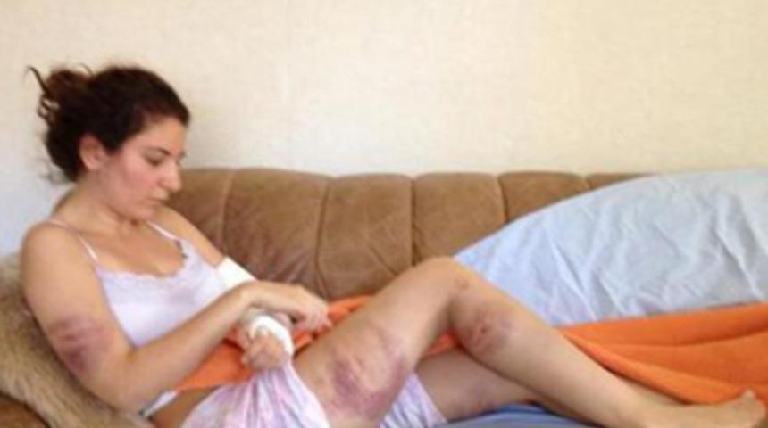 Twitter'dan dayak fotoğraflarını paylaştı