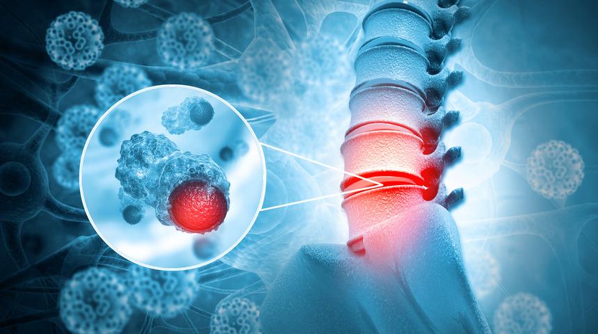 Sessizce ilerleyen tehlike: Hareket edemez hale getiriyor! Bu belirtiler varsa hemen hastaneye koşun