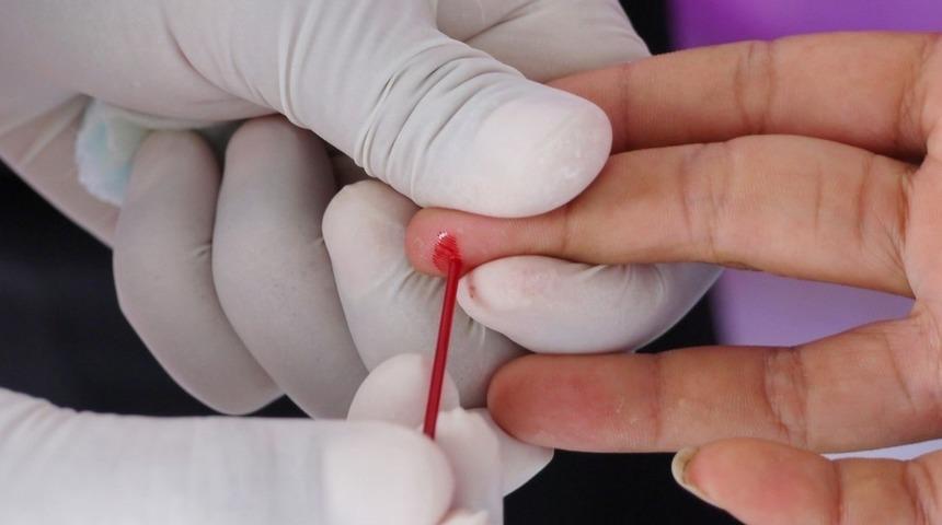 Uzman isim açıkladı: Türkiye nüfusunun yüzde 2,1'i taşıyıcı! En çok bu bölgede görülüyor