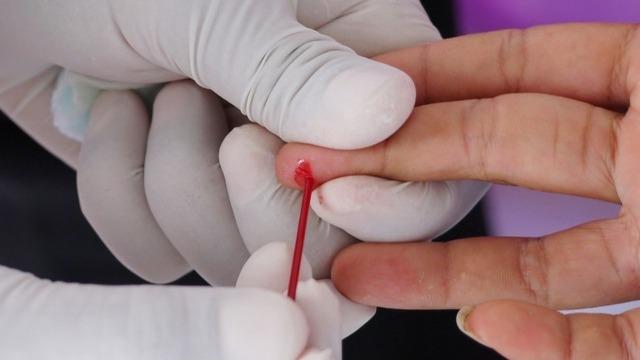 Uzman isim açıkladı: Türkiye nüfusunun yüzde 2,1'i taşıyıcı! En çok bu bölgede görülüyor