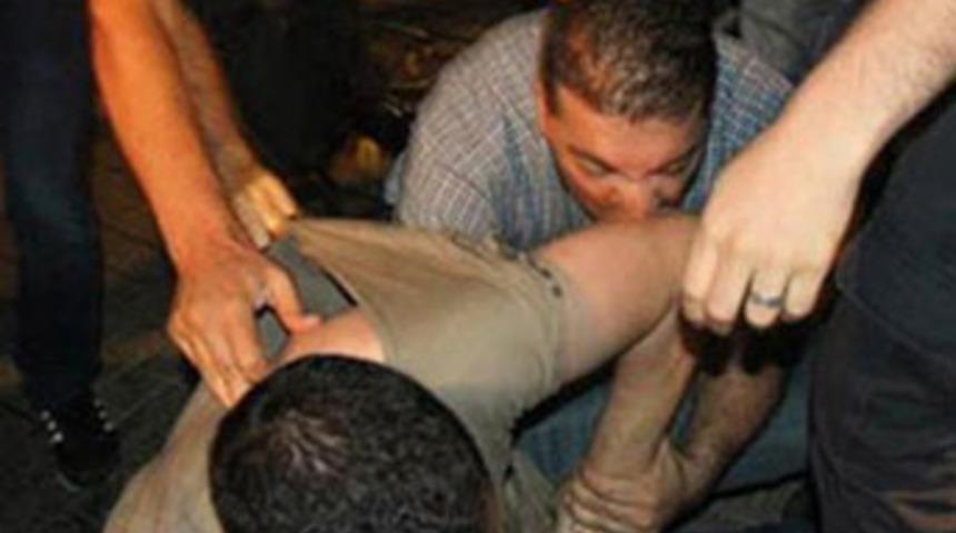 Polis göstericiyi böyle ısırdı