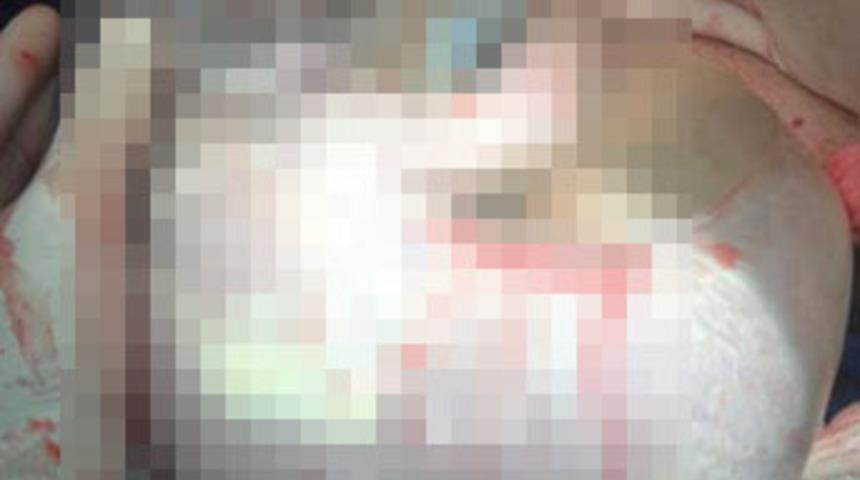 Doğumda b&uuml;y&uuml;k şok!