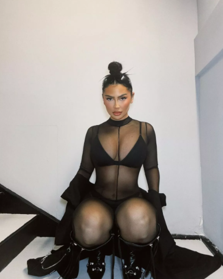 Kalçasını büyütmek isterken kabusu yaşadı! "Doktorlar enfeksiyonun kalçamı patlatacağını söyledi" G2