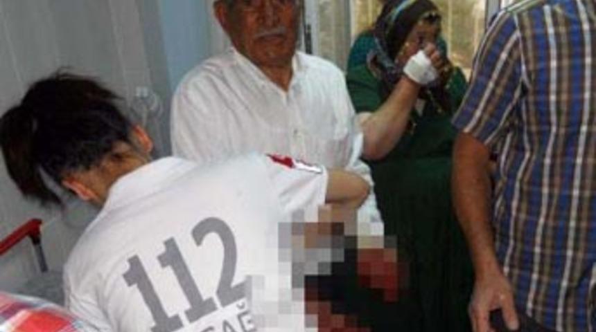 Sokak köpeği dehşet saçtı, 21 kişiyi ısırdı