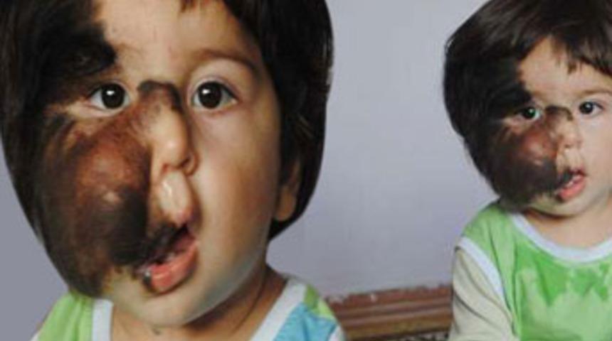 Minik Salih&rsquo;in y&uuml;rek burkan dramı