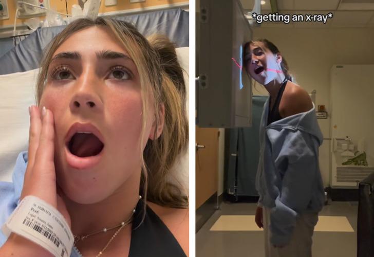 Sosyal medya fenomenin zor anları! Esnerken &ccedil;enesi &ccedil;ıktı... "D&ouml;rt doktor &ccedil;enemi tekrar bir araya getirdi"