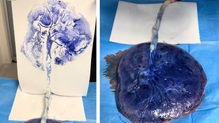 Bebeğin doğumundan sonra annesine verilen ilginç  hediye sosyal medyada çok konuşuldu! Plasentasında baskı yaptı