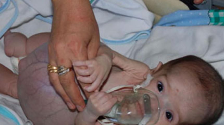 Yusuf bebek yaşamak i&ccedil;in yardım bekliyor