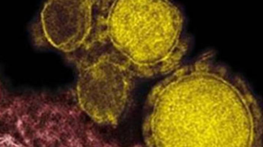 MERS vir&uuml;s&uuml; Ortadoğu'nun kabusu oldu