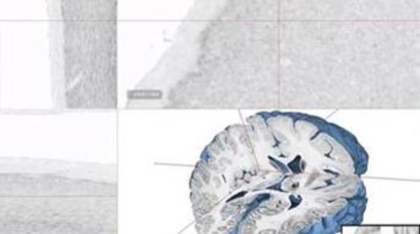 Bilinen en b&uuml;y&uuml;k beyin haritası: BigBrain