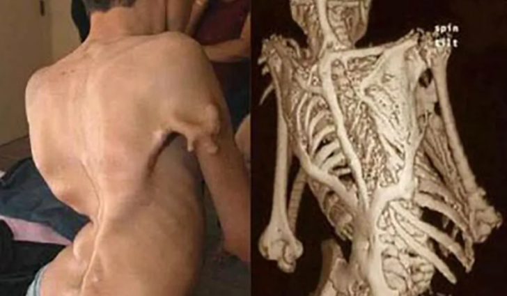 Nadir görülüyor: Daha önce hiç duymadığınız birbirinden tuhaf 10 hastalık! G2