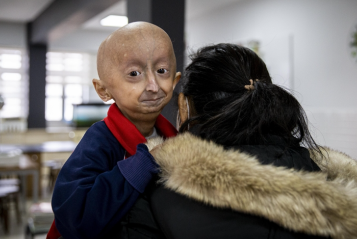 Nadir görülüyor: Daha önce hiç duymadığınız birbirinden tuhaf 10 hastalık! G3