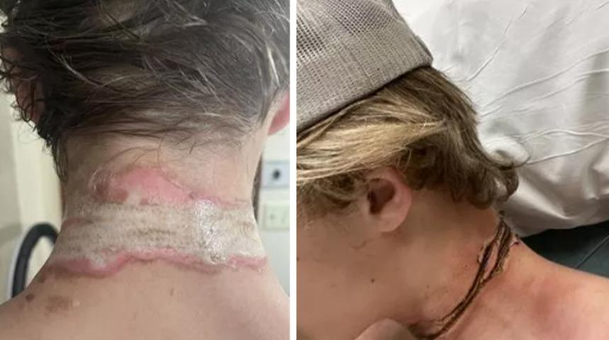 Oğlunun odasından gelen çığlık sesine uyandı! Kolyesi iletince elektrik çarptı... "Bütün ev yanık saç ve deri koktu"