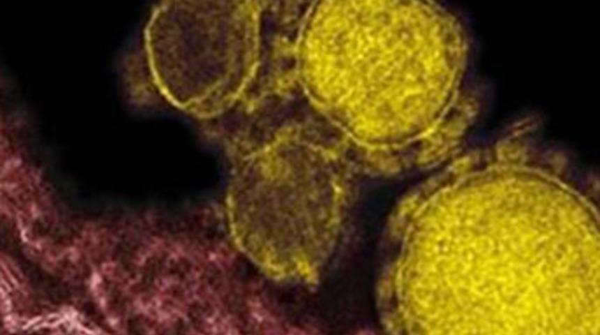MERS vir&uuml;s&uuml; Ortadoğu'nun kabusu oldu