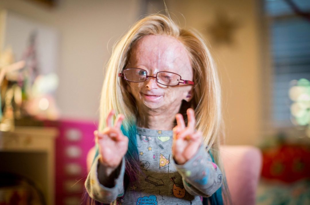 Nadir g&ouml;r&uuml;l&uuml;yor: Daha &ouml;nce hi&ccedil; duymadığınız birbirinden tuhaf 10 hastalık!