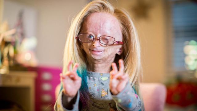 Nadir görülüyor: Daha önce hiç duymadığınız birbirinden tuhaf 10 hastalık!