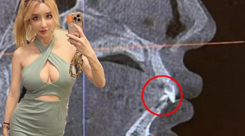 Havaalanı güvenliğinden geçerken sürekli olarak alarm verdi! "Cihazın kafamın içinde bulduğu şey beni şoke etti"