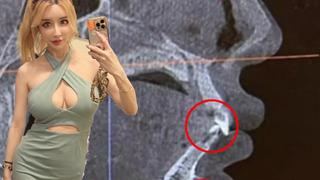 Havaalanı güvenliğinden geçerken sürekli olarak alarm verdi! Cihazın kafamın içinde bulduğu şey beni şoke etti