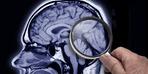Demans ve Alzheimer: Belirtileri neler, hangi tedaviler uygulanıyor?
