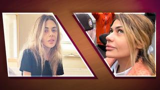 37 kiloya düşünce tahliye edildi! 20 kilo alıp estetik yaptıran Nihal Candan isyan etti