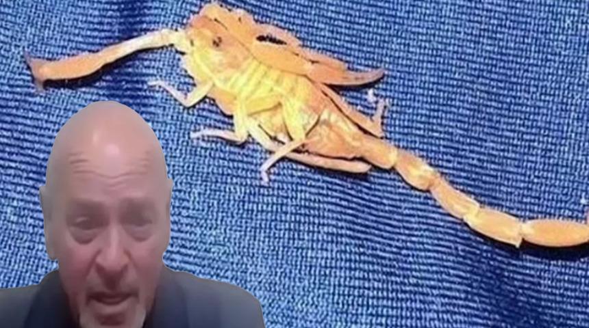 Otel odasında pantolonunun içine giren akrebin saldırısına uğradı! Uyurken defalarca kasık bölgesinden ısırıldı: Oteli dava etti